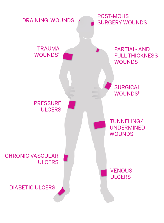 The various wound types PuraPly AM can help heal